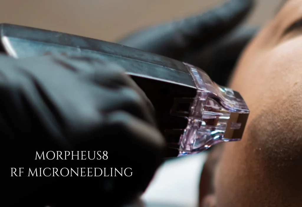 Morpheus8The Ultimate Skin Tightening and Contouring Solution at Oasis Aesthetics and Wellness in Pompano Beach, FL